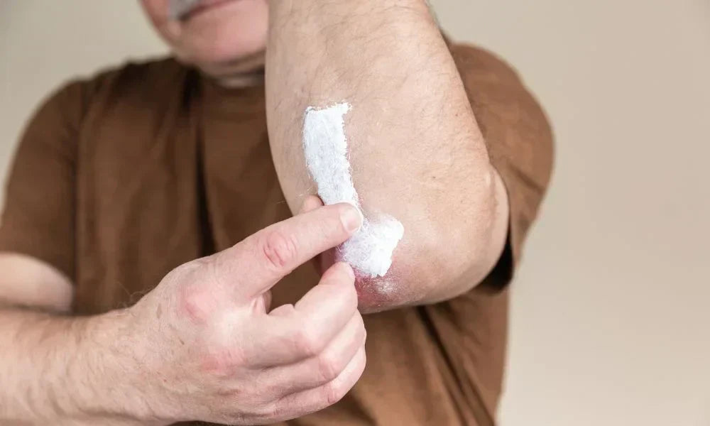 Say "GOODBYE" to Dry, Flaky Skin